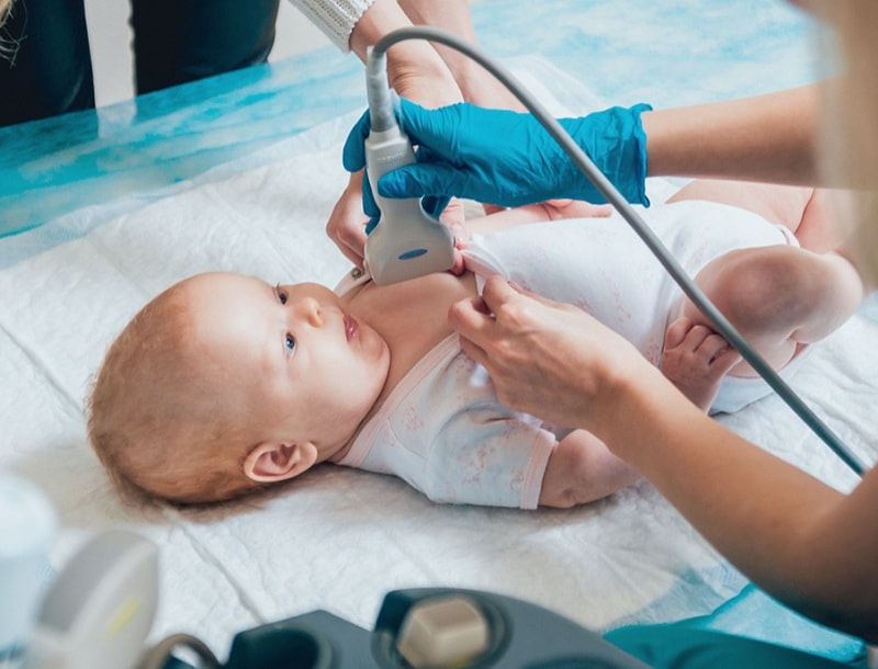 Ultrasound of infants and children in nicu ward