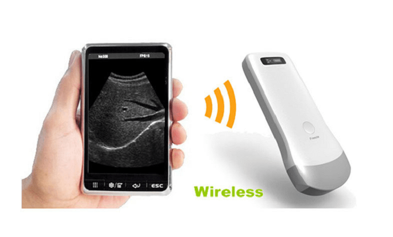 Handheld ultrasound